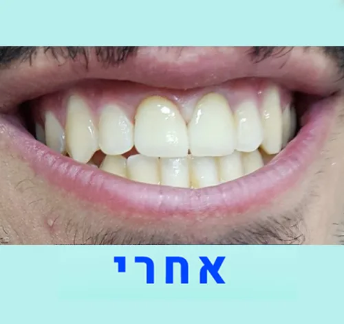 עבודת מעבדה לאחר תיקון