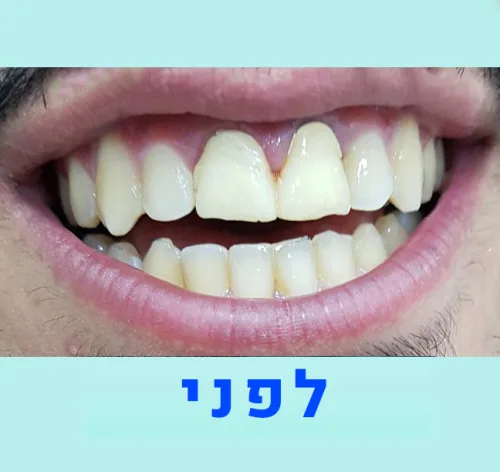 עבודת מעבדה לפני תיקון